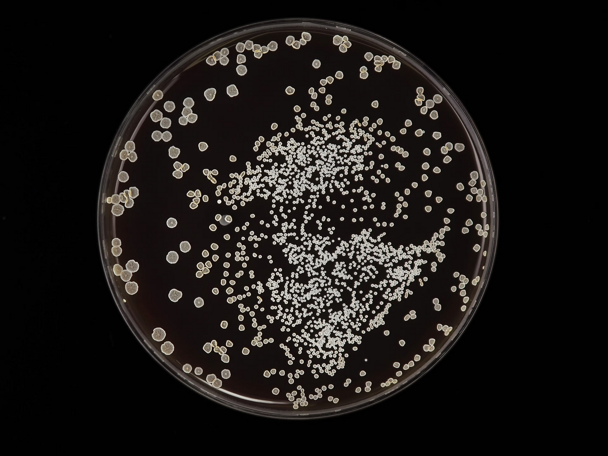 Žalias mėsos maistas šunims mikrobiologijos požiūriu